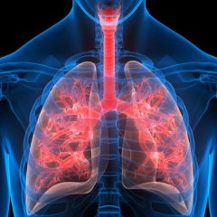 Scientists Find Potential Diagnostic And Therapeutic Target For Lung Cancer