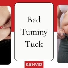 How to Fix Bad Tummy Tuck To Restore Confidence and Looks?