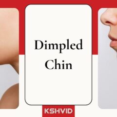 The Charms & Myths Behind The Endearing Dimpled Chin 