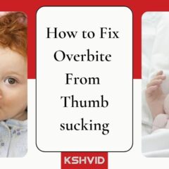 Thumbsucking; Fixing Overbite With Effective Techniques 2023