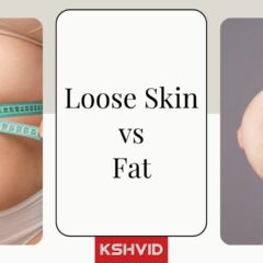 How Do You Know If It's Fat Or Loose Skin?