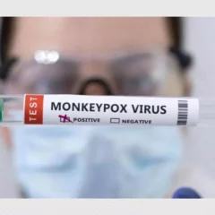 Monkeypox Alert : 5 points you should know about Monkeypox!