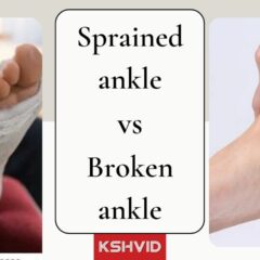 Sprained Ankle Vs Broken Ankle | Symptoms & Treatment